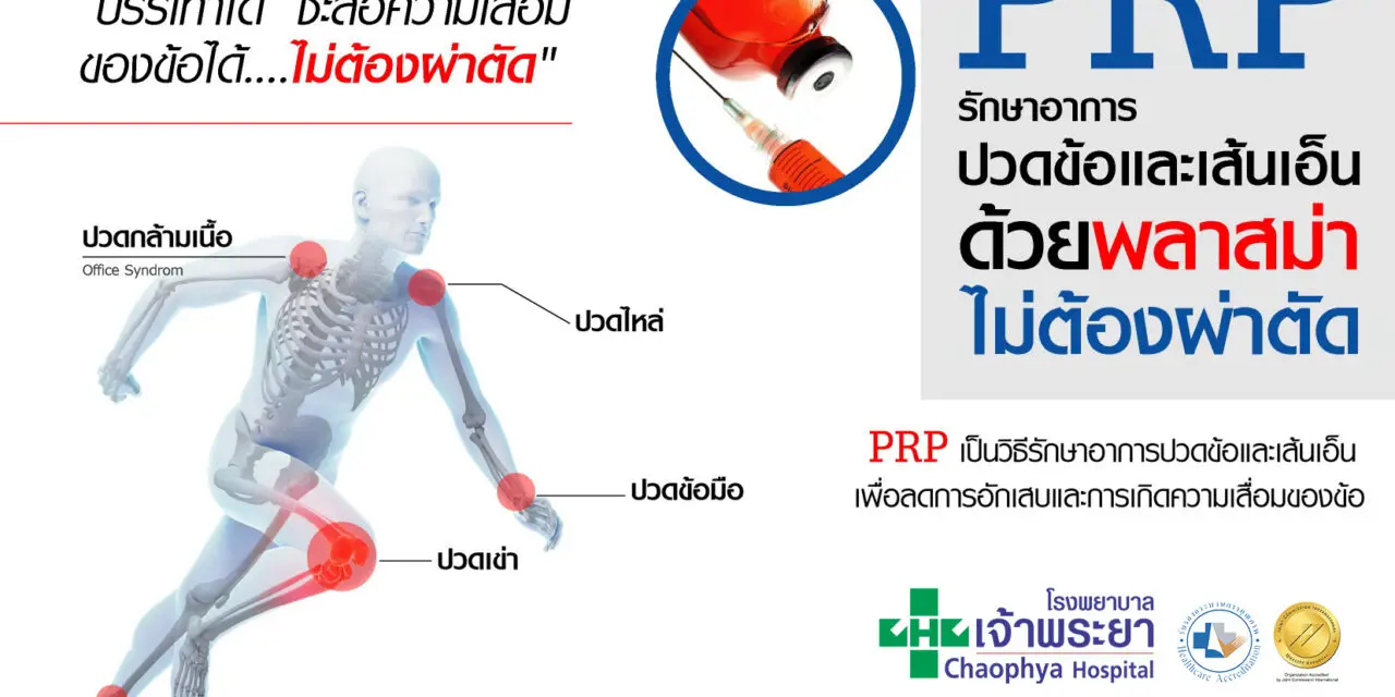 “รพ.เจ้าพระยารักษาปวดข้อด้วยพลาสม่า”