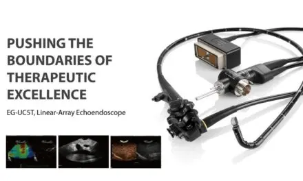 SonoScape ได้รับเครื่องหมาย CE Mark  สำหรับกล้องเอ็นโดสโคปติดอัลตราซาวด์รุ่น EG-UC5T